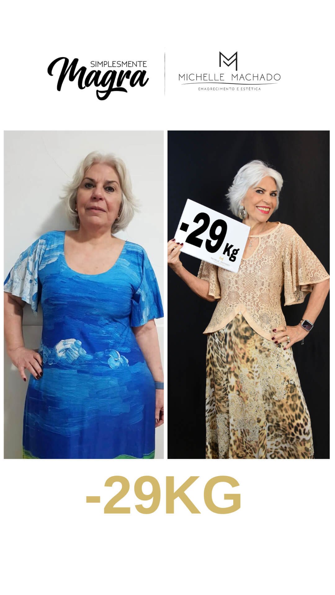 Antes-e-Depois-emagrecimento-.zip-16.jpg