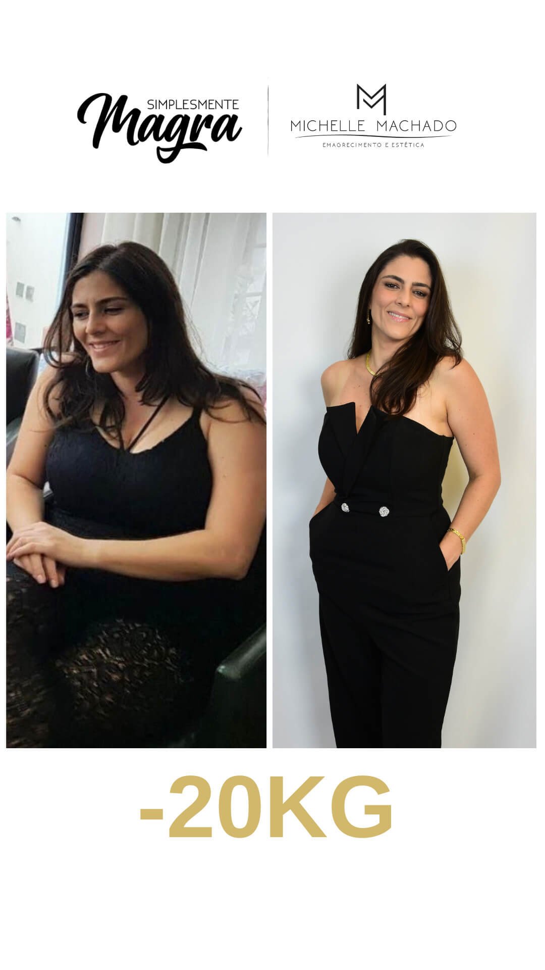 Antes-e-Depois-emagrecimento-.zip-5.jpg