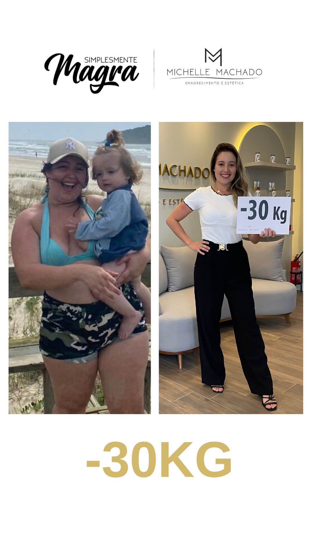 Antes-e-Depois-emagrecimento-.zip-9.jpg