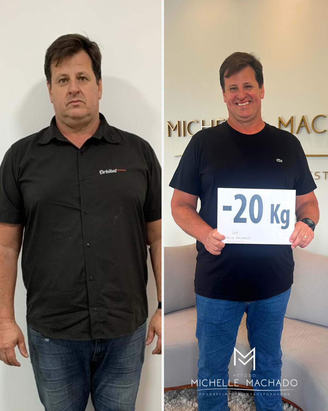 Antes e Depois emagrecimento - 1