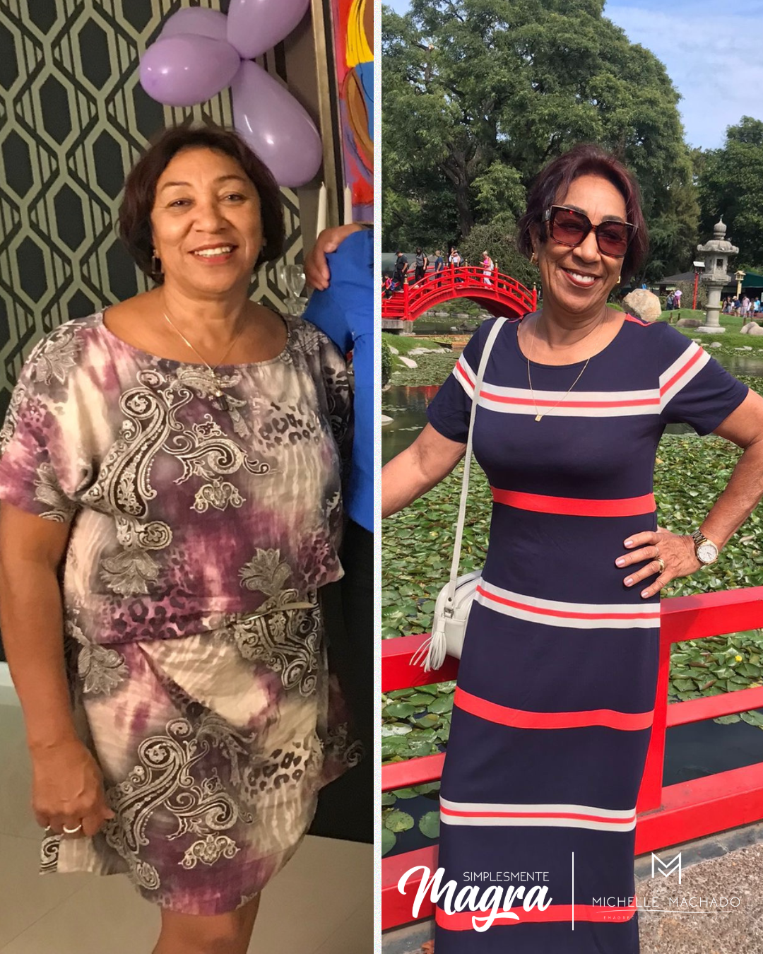 Antes e Depois emagrecimento - 10