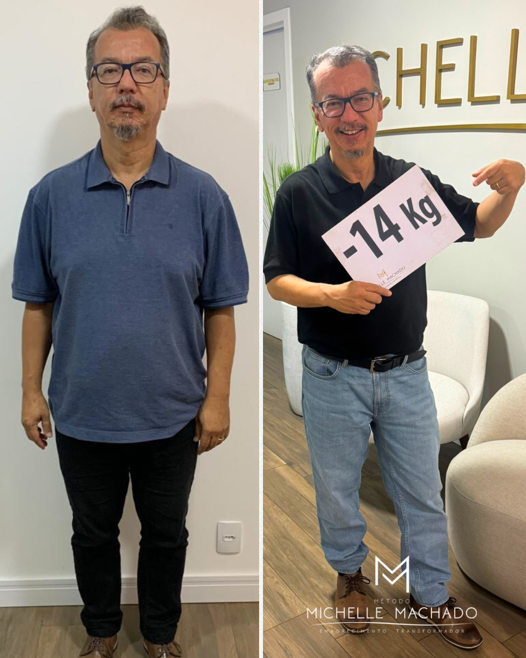 Antes e Depois emagrecimento - 12