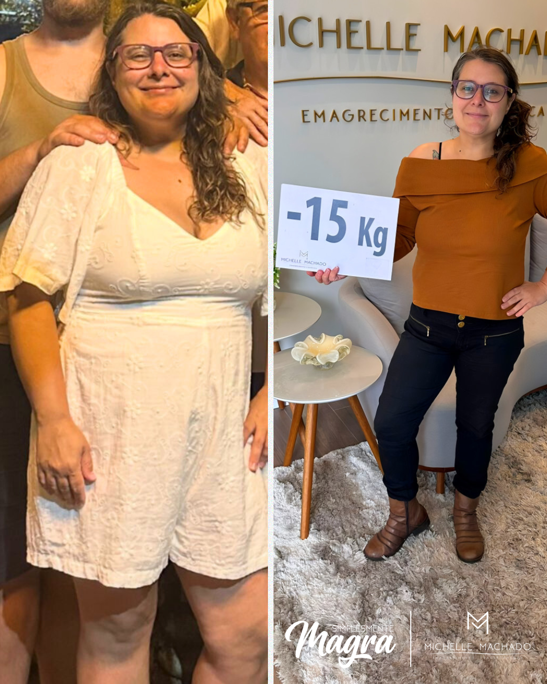 Antes e Depois emagrecimento - 13