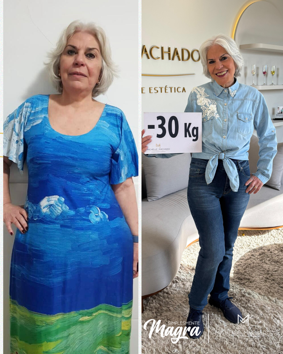 Antes e Depois emagrecimento - 16