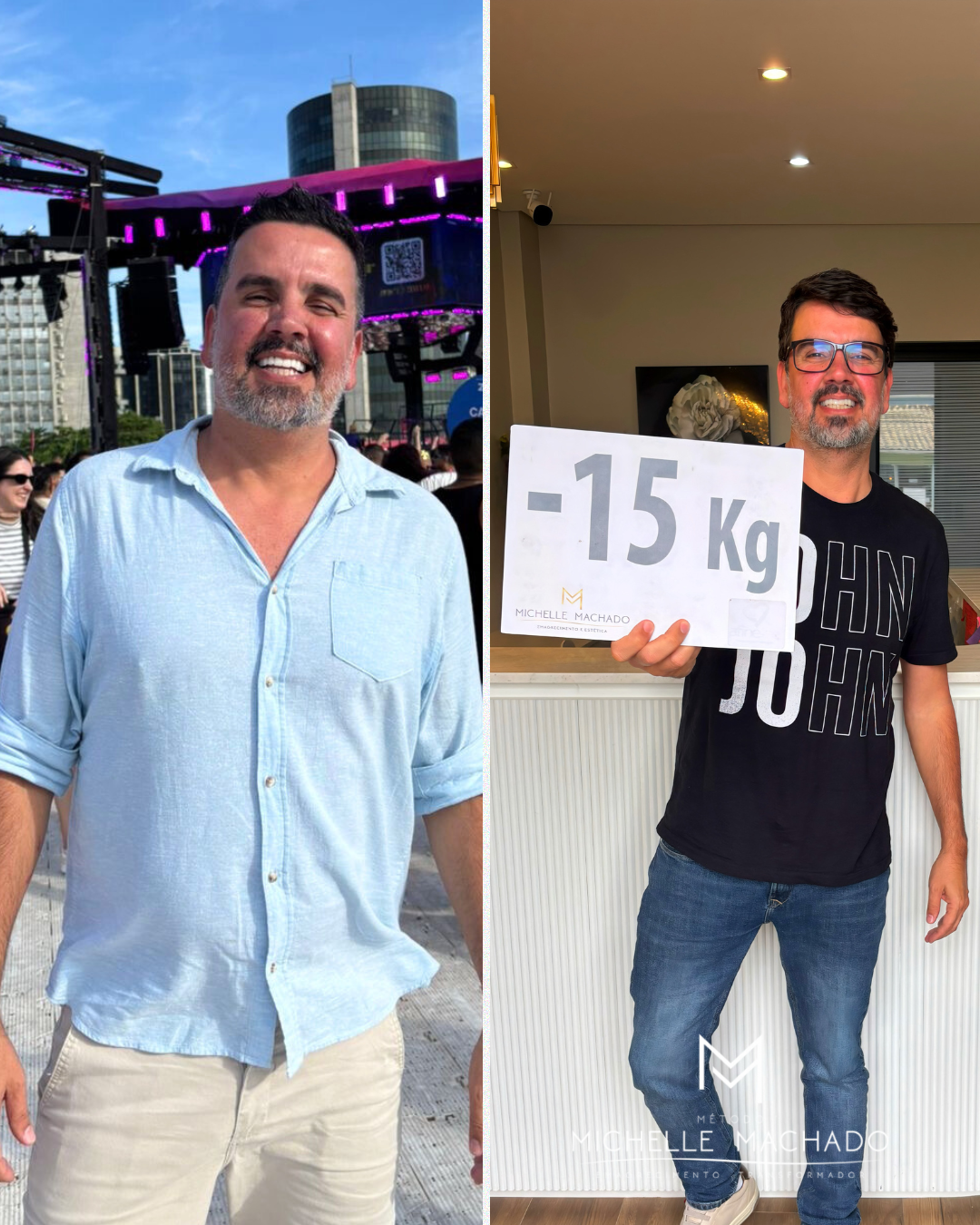 Antes e Depois emagrecimento - 2