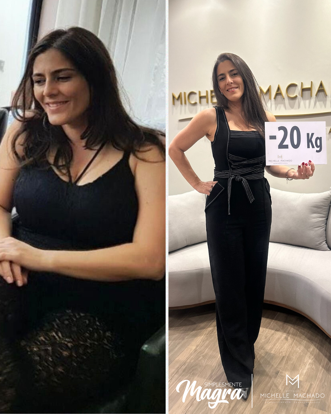 Antes e Depois emagrecimento - 20