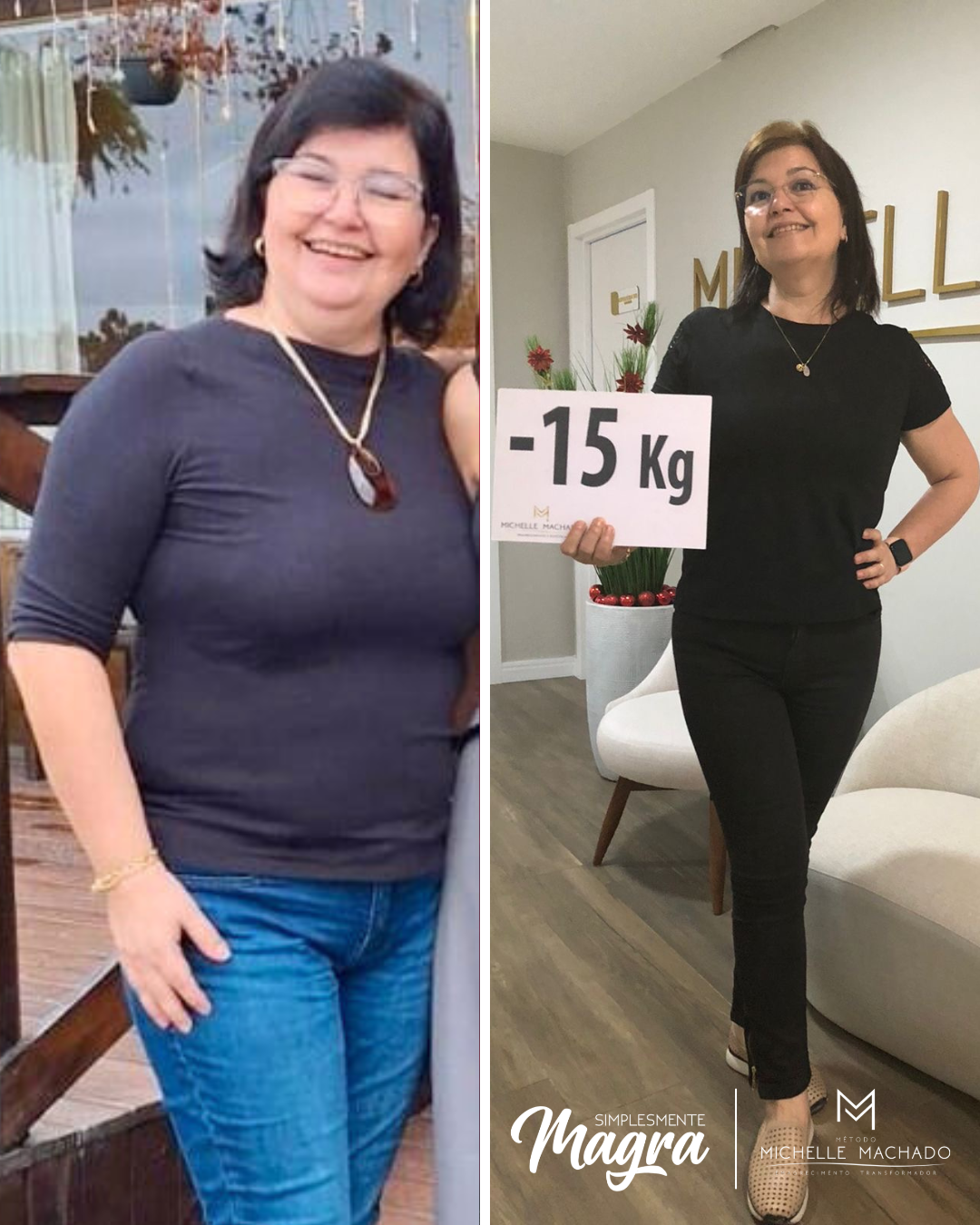 Antes e Depois emagrecimento - 24