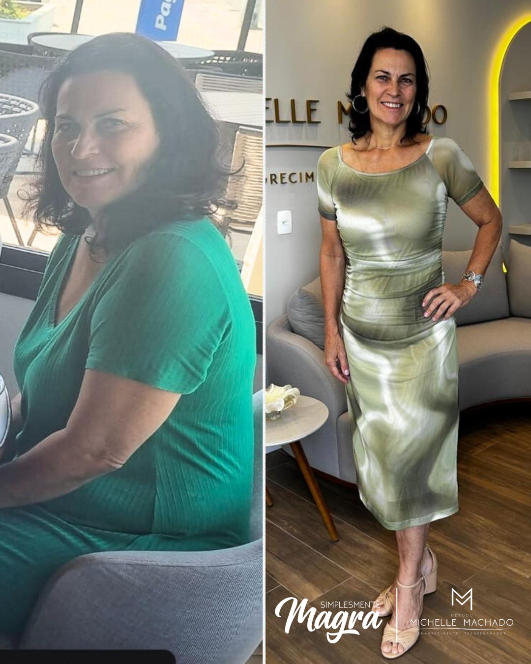 Antes e Depois emagrecimento - 3