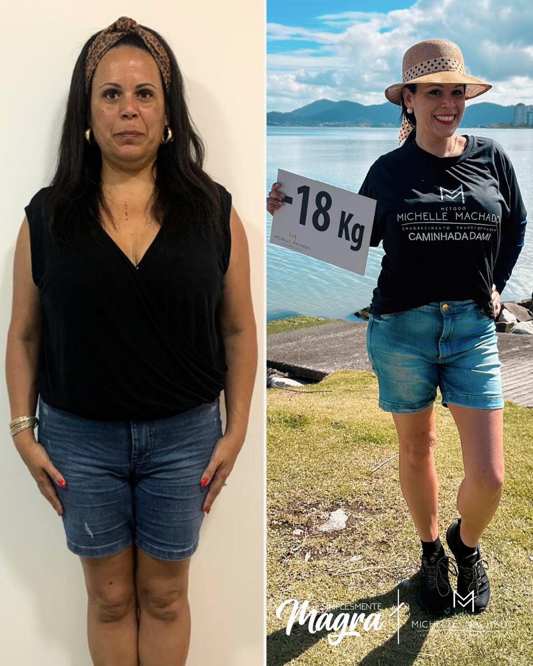 Antes e Depois emagrecimento - 4