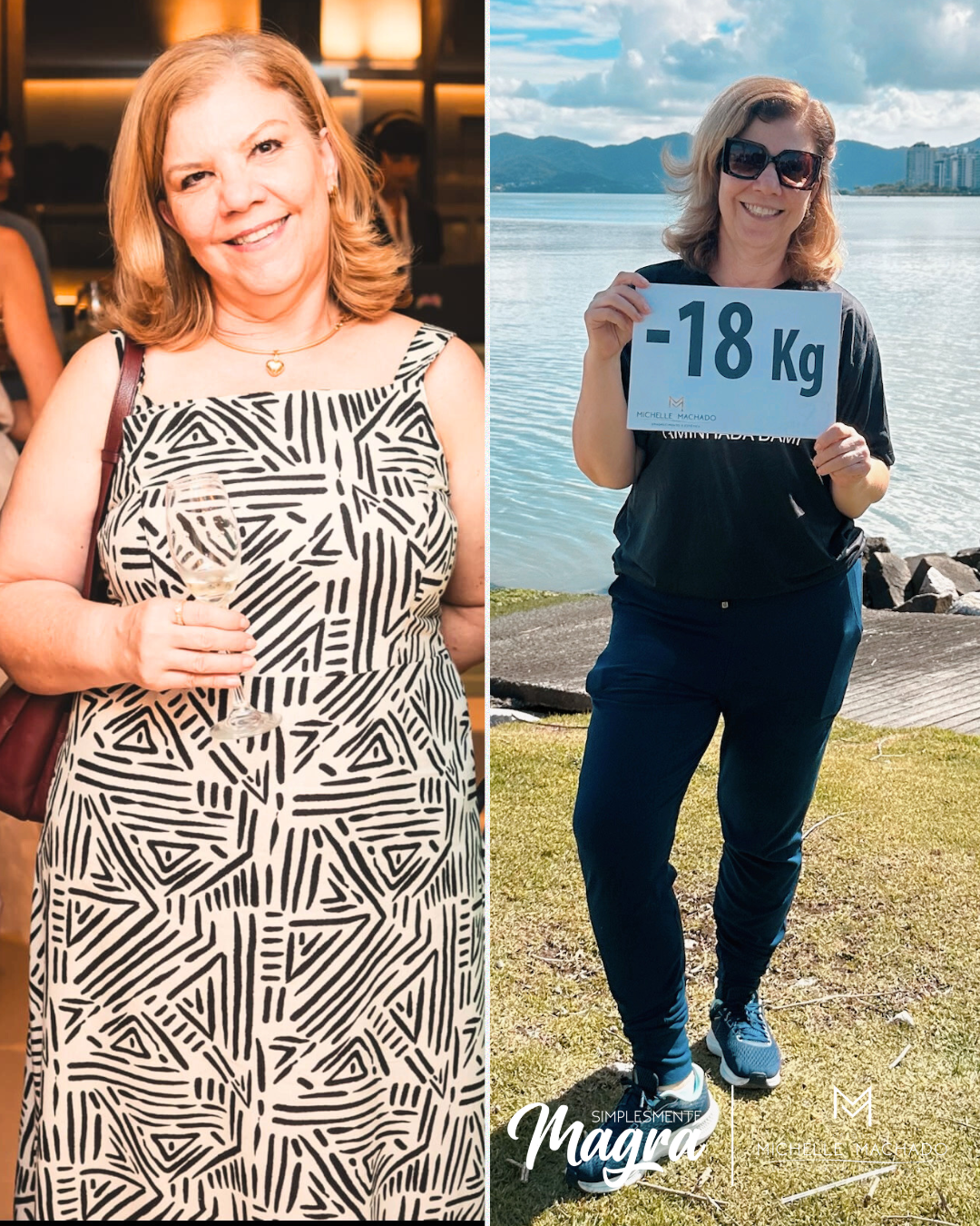 Antes e Depois emagrecimento - 5