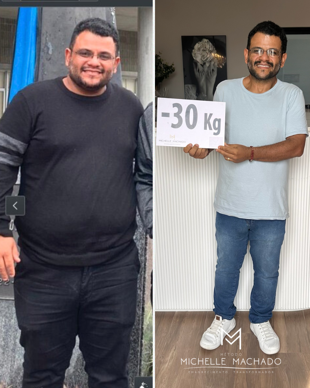 Antes e Depois emagrecimento - 6