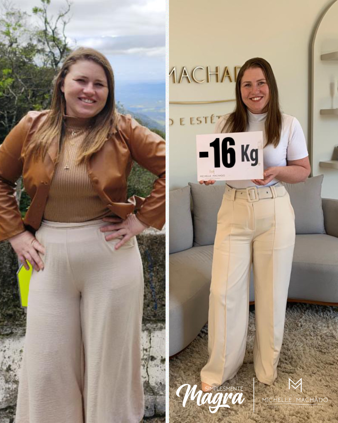 Antes e Depois emagrecimento - 8