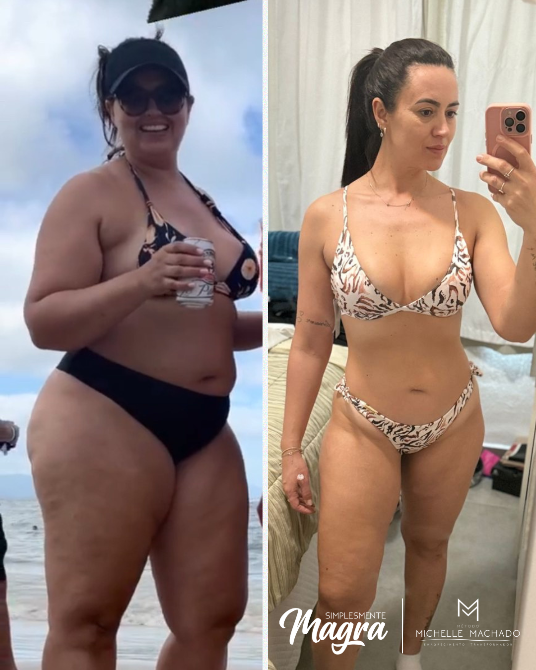 Antes e Depois emagrecimento - 9